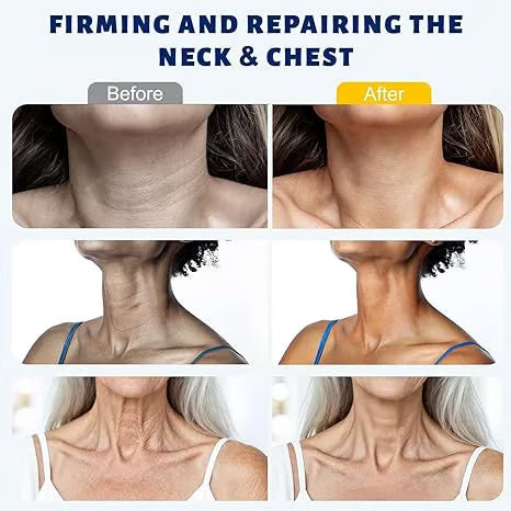 Juxek® Neck Firming Cream Reduces Wrinkles and Double Chin,Five Rollers for All Around Massage