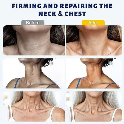 Juxek® Neck Firming Cream Reduces Wrinkles and Double Chin,Five Rollers for All Around Massage