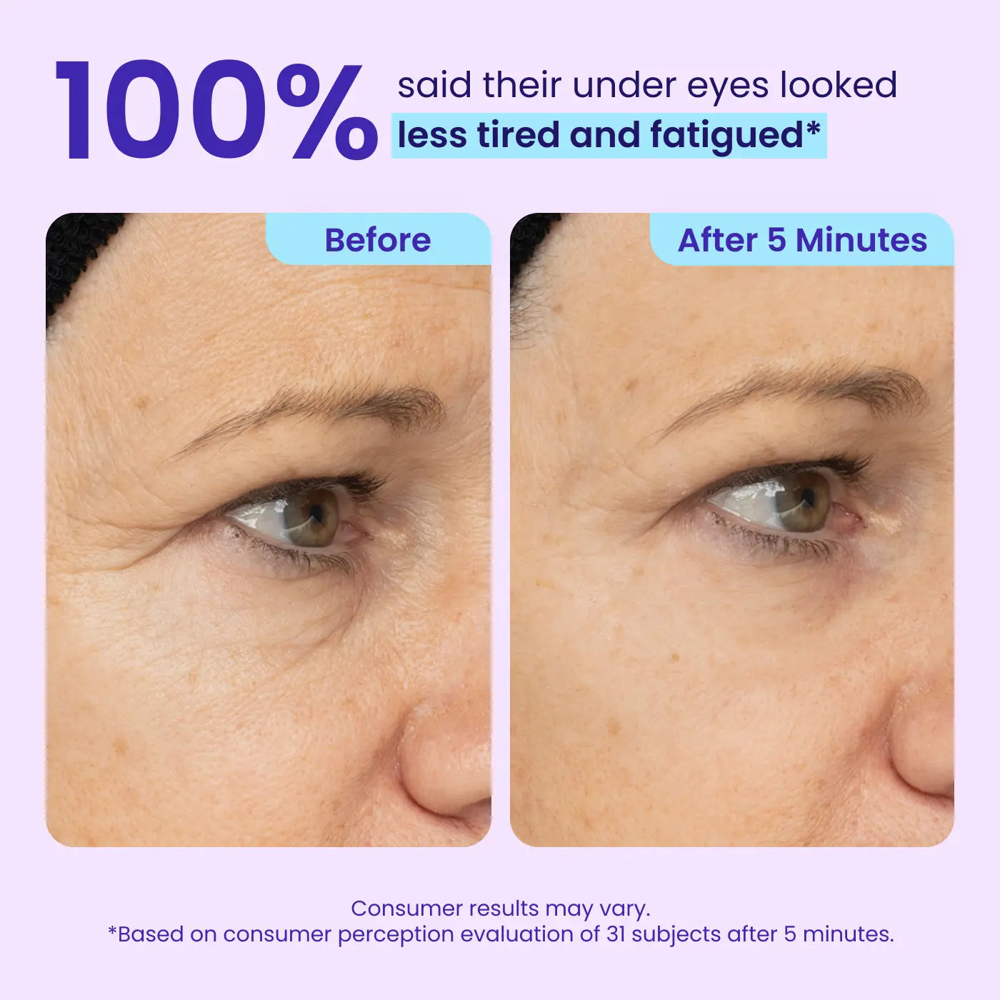 Official Store 🇺🇸 | Instant Lift All-in-One Firming Gel—Instant Solution for Wrinkles, Dark Circles & Sagging (Multi-Area Use)
