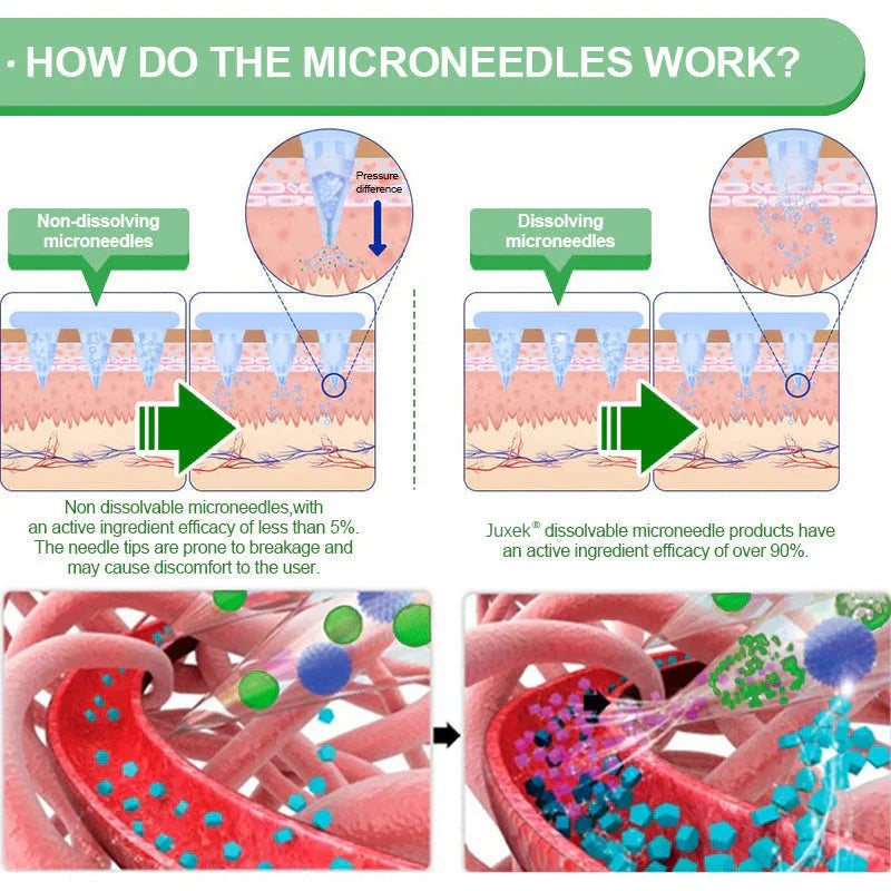 New 2026 Upgrade: Juxek® Berberine 10-in-1 Nano Microneedle Patch with Science-Backed Formula