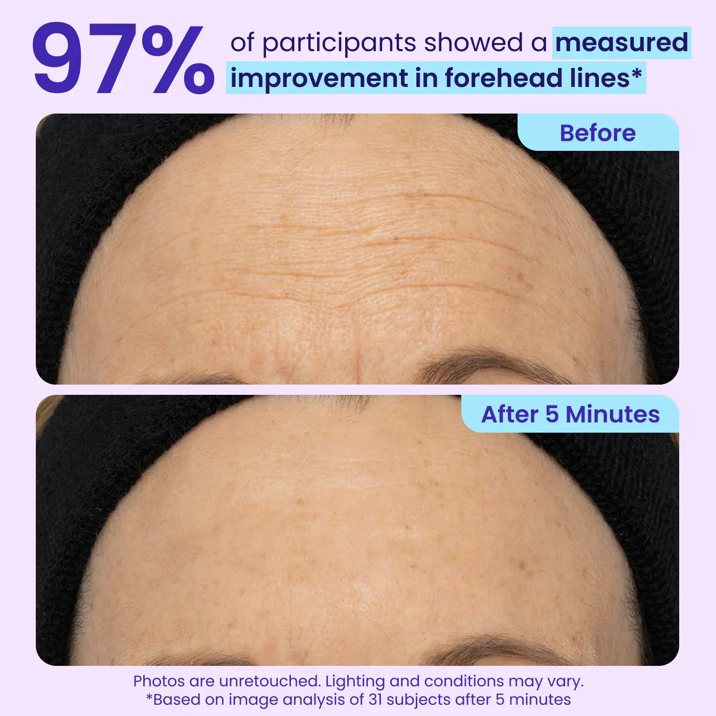 Official Store 🇺🇸 | Instant Lift All-in-One Firming Gel—Instant Solution for Wrinkles, Dark Circles & Sagging (Multi-Area Use)